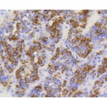 Immunohistochemistry - Anti-TOMM20 Antibody (A11308) - Antibodies.com
