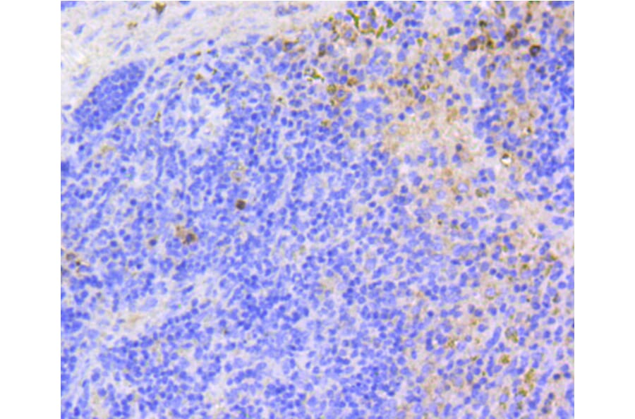 Immunohistochemistry - Anti-ARPC5 Antibody (A11317) - Antibodies.com