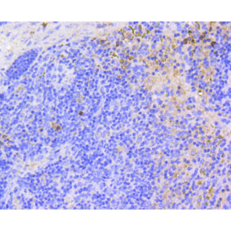 Immunohistochemistry - Anti-ARPC5 Antibody (A11317) - Antibodies.com