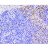 Immunohistochemistry - Anti-ARPC5 Antibody (A11317) - Antibodies.com
