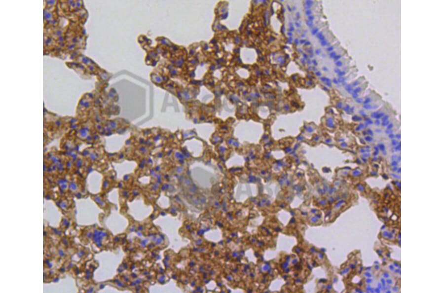 Immunohistochemistry - Anti-ARPC5 Antibody (A11317) - Antibodies.com