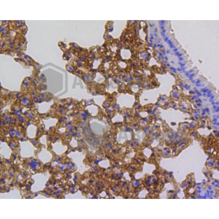 Immunohistochemistry - Anti-ARPC5 Antibody (A11317) - Antibodies.com