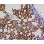 Immunohistochemistry - Anti-ARPC5 Antibody (A11317) - Antibodies.com