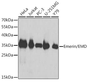 Western Blot - Anti-Emerin Antibody (A13285) - Antibodies.com
