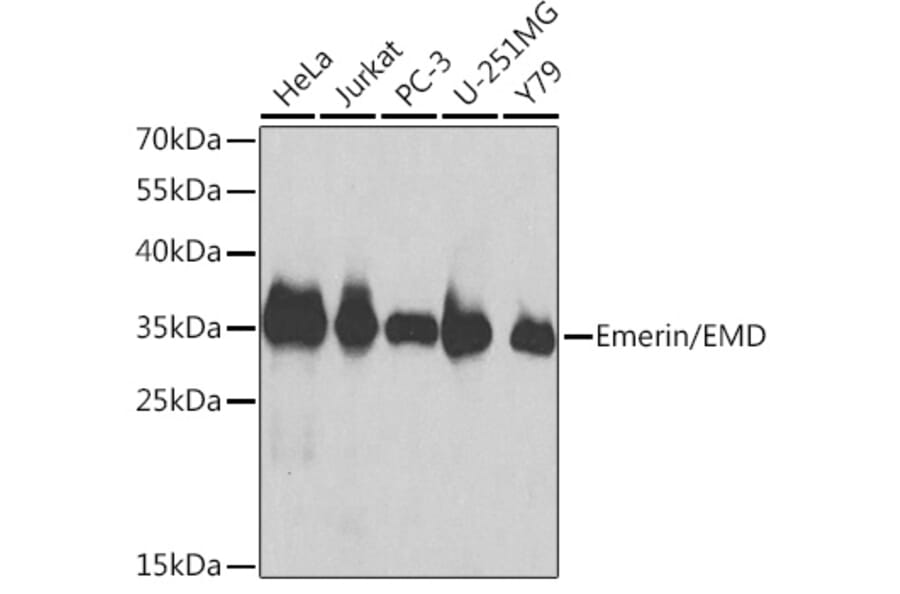 Western Blot - Anti-Emerin Antibody (A13285) - Antibodies.com