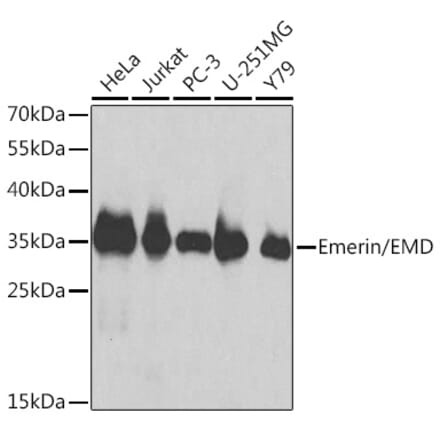 Western Blot - Anti-Emerin Antibody (A13285) - Antibodies.com