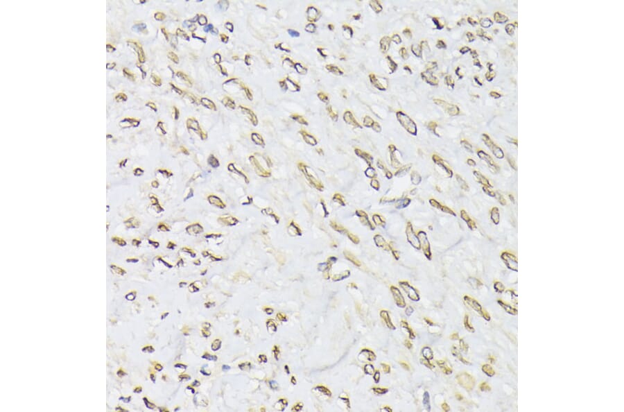 Immunohistochemistry - Anti-Emerin Antibody (A13285) - Antibodies.com