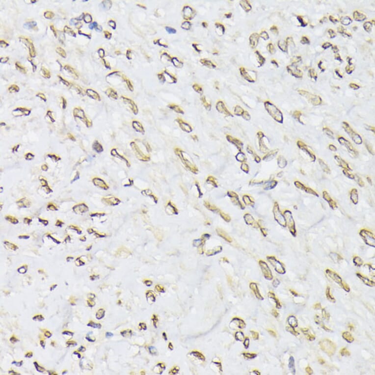 Immunohistochemistry - Anti-Emerin Antibody (A13285) - Antibodies.com