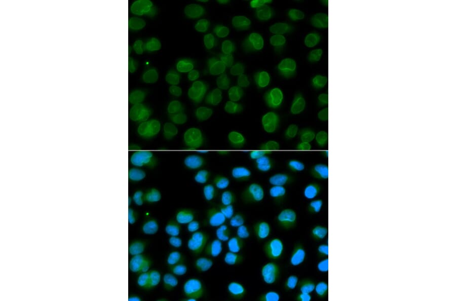 Immunofluorescence - Anti-Emerin Antibody (A13285) - Antibodies.com