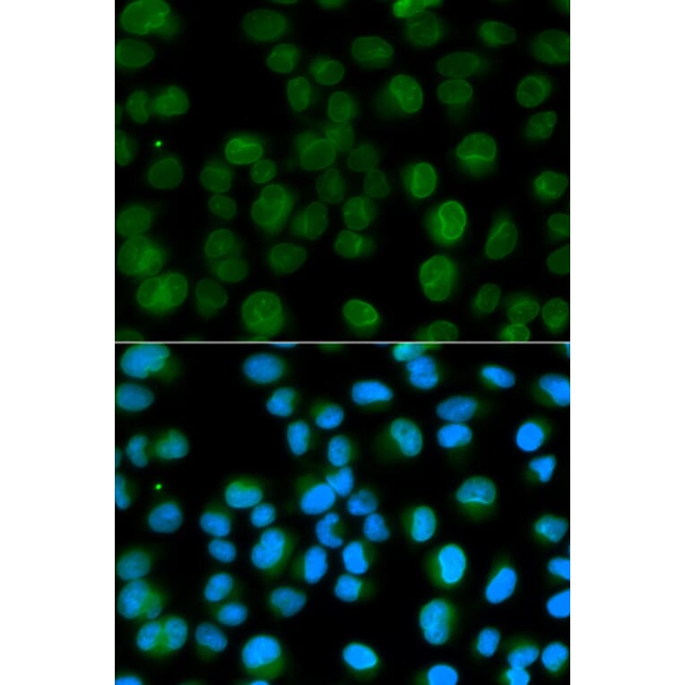 Immunofluorescence - Anti-Emerin Antibody (A13285) - Antibodies.com