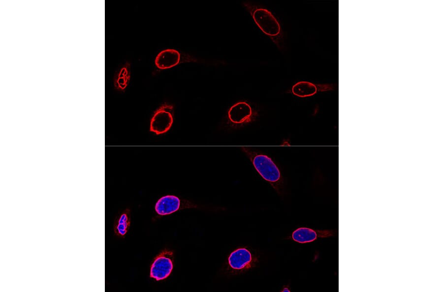 Immunofluorescence - Anti-Emerin Antibody (A13285) - Antibodies.com