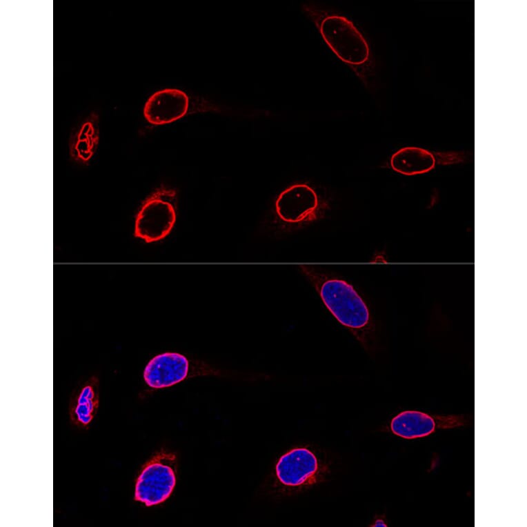 Immunofluorescence - Anti-Emerin Antibody (A13285) - Antibodies.com