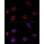 Immunofluorescence - Anti-Emerin Antibody (A13285) - Antibodies.com