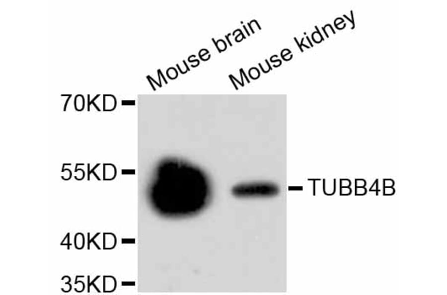 Western Blot - Anti-Tubulin Beta 2 Antibody (A11320) - Antibodies.com