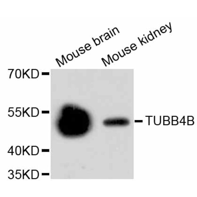 Western Blot - Anti-Tubulin Beta 2 Antibody (A11320) - Antibodies.com