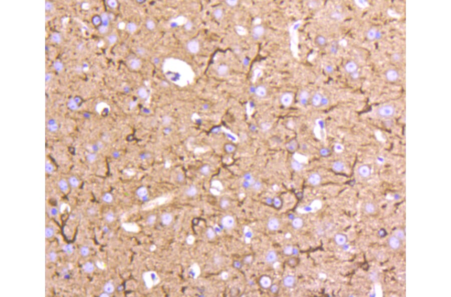 Immunohistochemistry - Anti-Tubulin Beta 2 Antibody (A11320) - Antibodies.com
