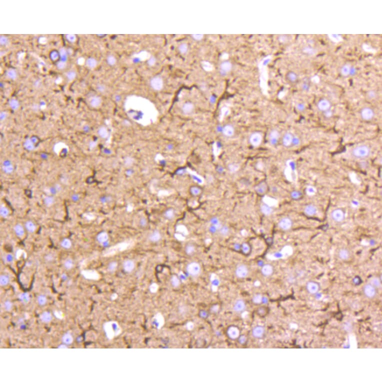 Immunohistochemistry - Anti-Tubulin Beta 2 Antibody (A11320) - Antibodies.com