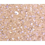 Immunohistochemistry - Anti-Tubulin Beta 2 Antibody (A11320) - Antibodies.com