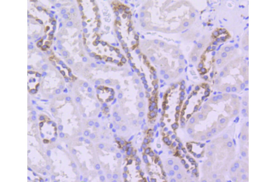 Immunohistochemistry - Anti-Tubulin Beta 2 Antibody (A11320) - Antibodies.com