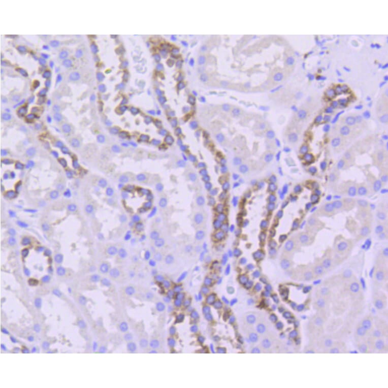 Immunohistochemistry - Anti-Tubulin Beta 2 Antibody (A11320) - Antibodies.com
