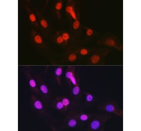 Immunofluorescence - Anti-CTCF Antibody (A13288) - Antibodies.com