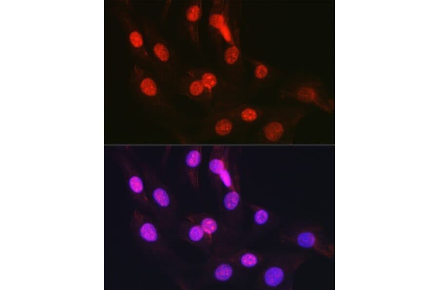 Immunofluorescence - Anti-CTCF Antibody (A13288) - Antibodies.com