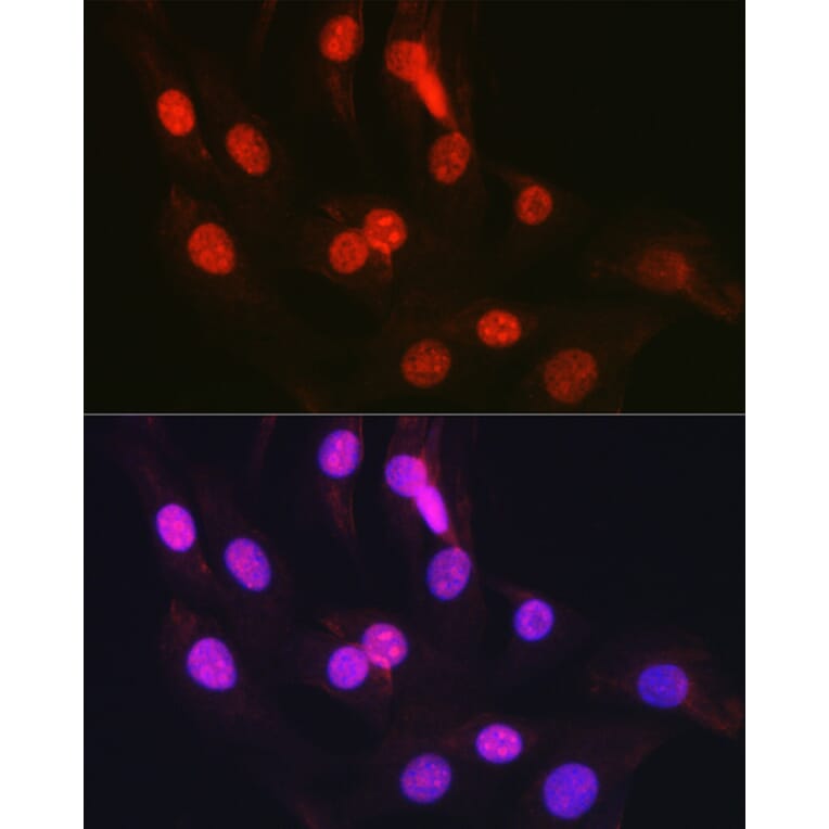 Immunofluorescence - Anti-CTCF Antibody (A13288) - Antibodies.com