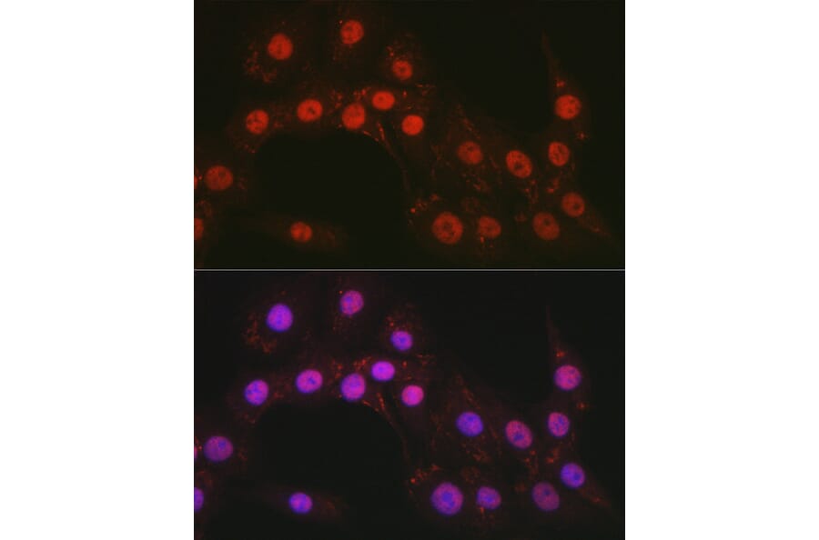 Immunofluorescence - Anti-CTCF Antibody (A13288) - Antibodies.com
