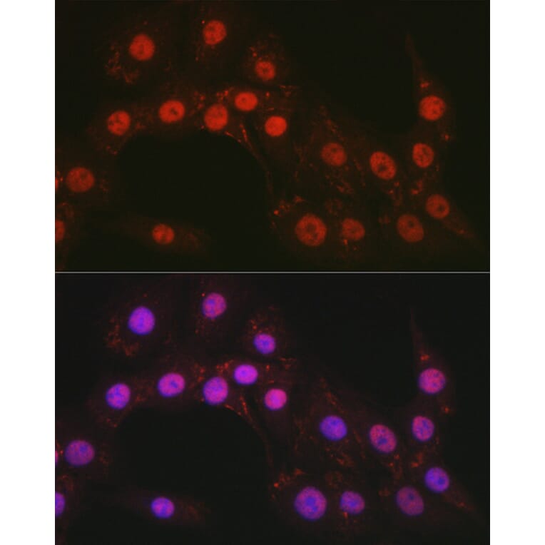 Immunofluorescence - Anti-CTCF Antibody (A13288) - Antibodies.com