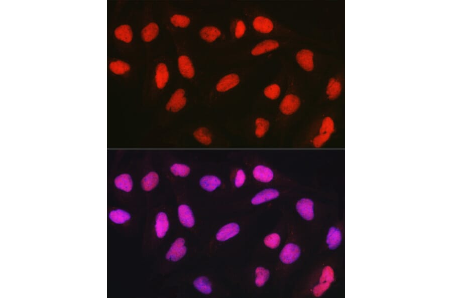 Immunofluorescence - Anti-CTCF Antibody (A13288) - Antibodies.com