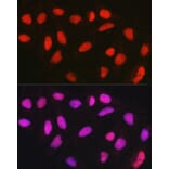 Immunofluorescence - Anti-CTCF Antibody (A13288) - Antibodies.com