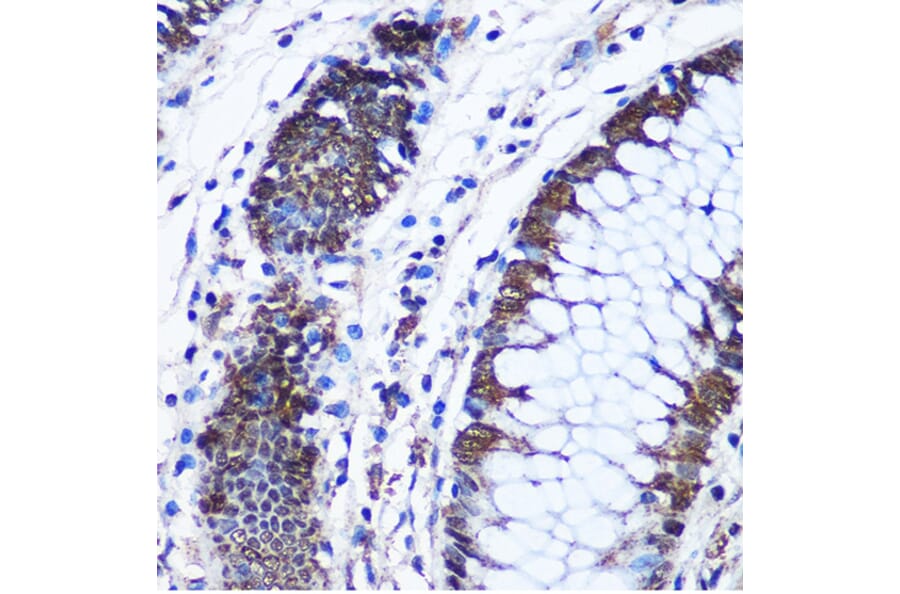 Chromatin Immunoprecipitation - Anti-CTCF Antibody (A13288) - Antibodies.com
