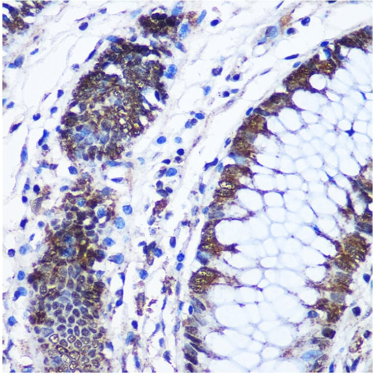 Chromatin Immunoprecipitation - Anti-CTCF Antibody (A13288) - Antibodies.com