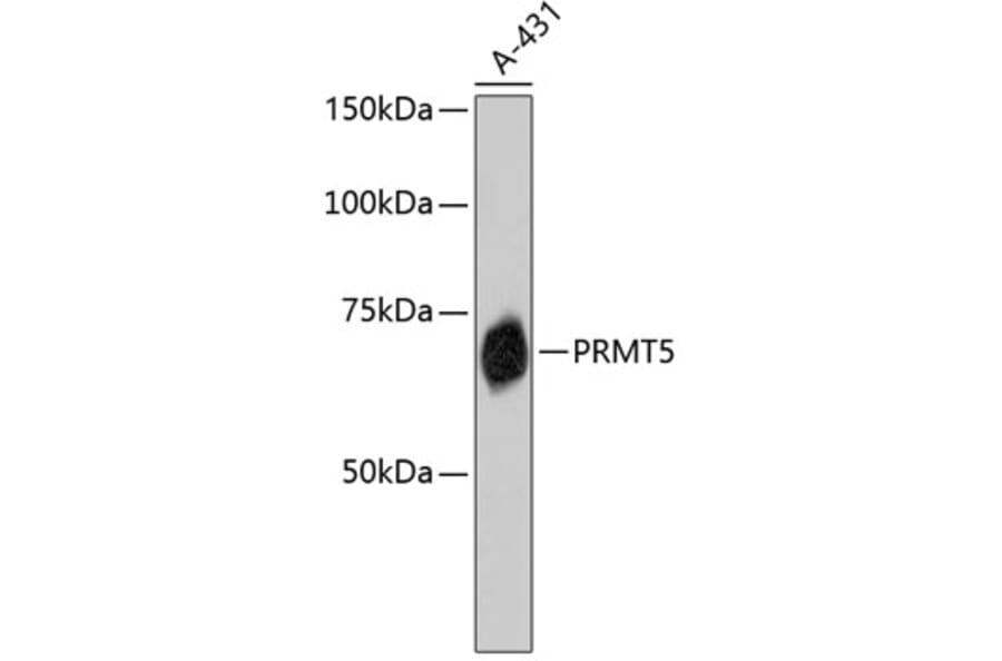 Western Blot - Anti-PRMT5 Antibody (A11335) - Antibodies.com