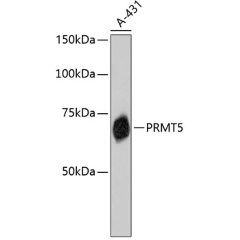 Western Blot - Anti-PRMT5 Antibody (A11335) - Antibodies.com