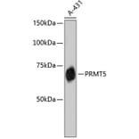 Western Blot - Anti-PRMT5 Antibody (A11335) - Antibodies.com