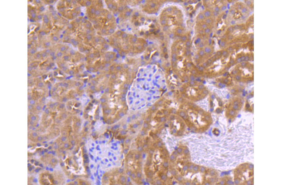 Immunohistochemistry - Anti-PRMT5 Antibody (A11335) - Antibodies.com