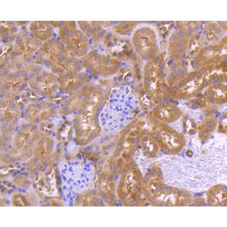 Immunohistochemistry - Anti-PRMT5 Antibody (A11335) - Antibodies.com