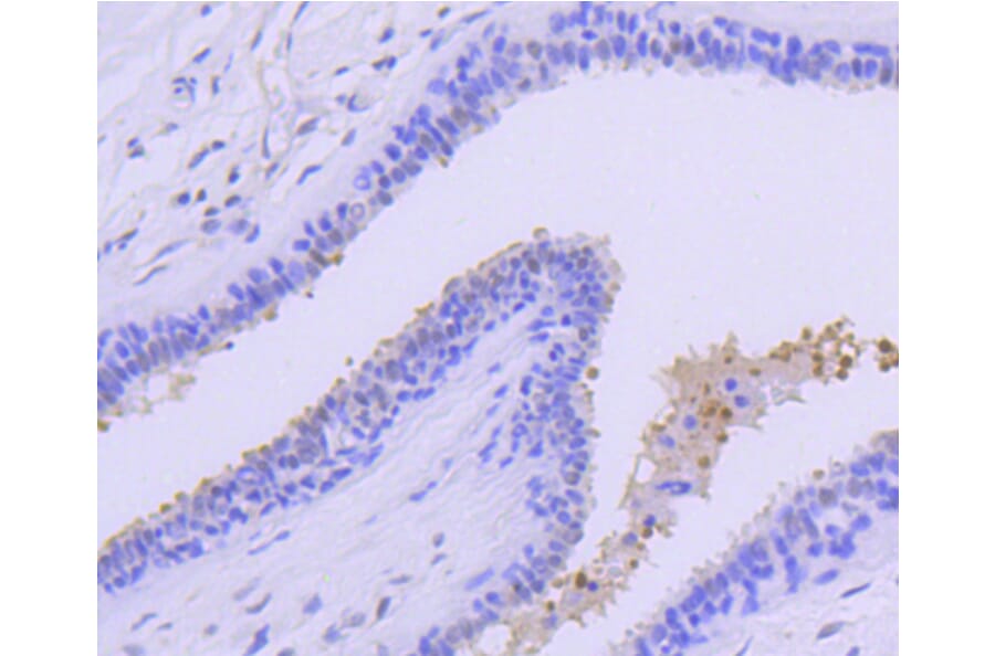 Immunohistochemistry - Anti-PRMT5 Antibody (A11335) - Antibodies.com
