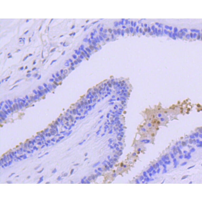 Immunohistochemistry - Anti-PRMT5 Antibody (A11335) - Antibodies.com