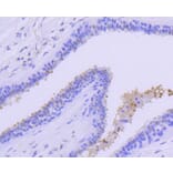 Immunohistochemistry - Anti-PRMT5 Antibody (A11335) - Antibodies.com