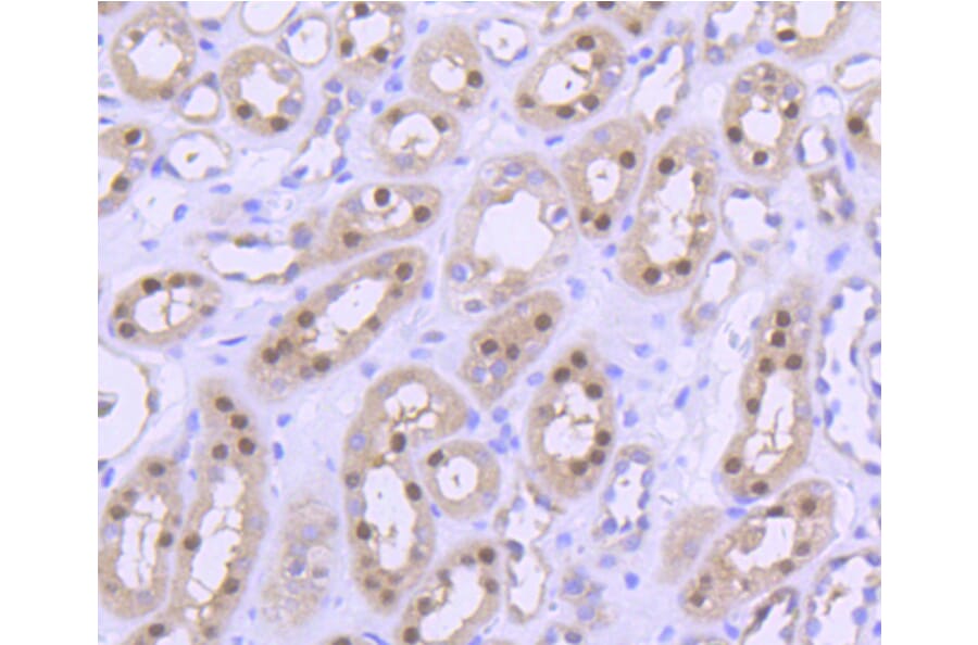 Immunohistochemistry - Anti-PRMT5 Antibody (A11335) - Antibodies.com