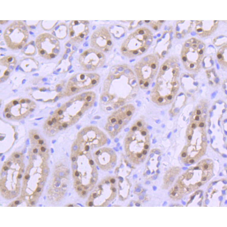 Immunohistochemistry - Anti-PRMT5 Antibody (A11335) - Antibodies.com