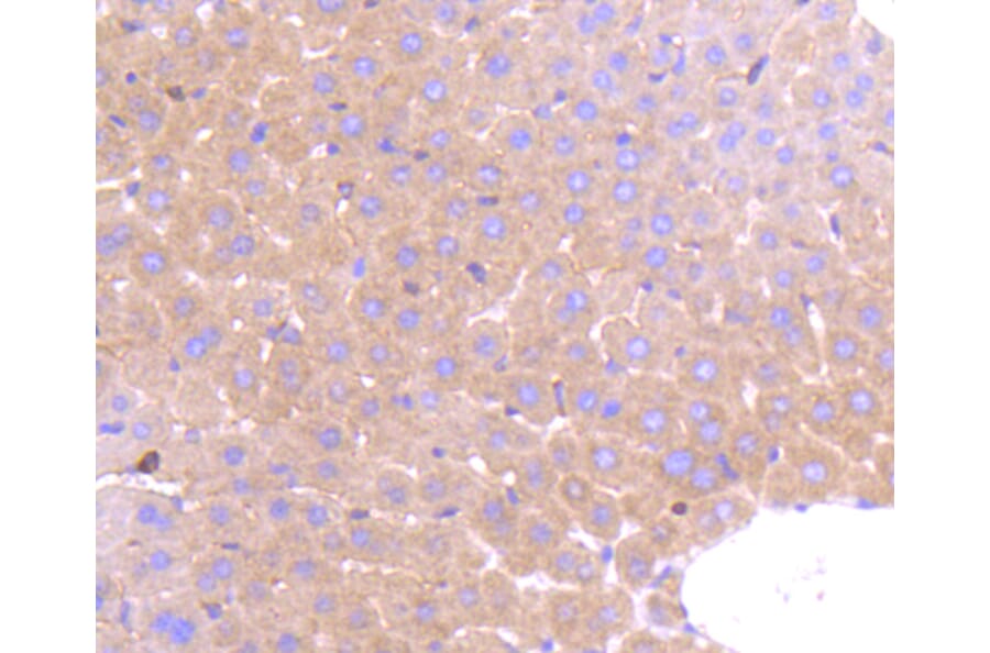 Immunohistochemistry - Anti-PRMT5 Antibody (A11335) - Antibodies.com