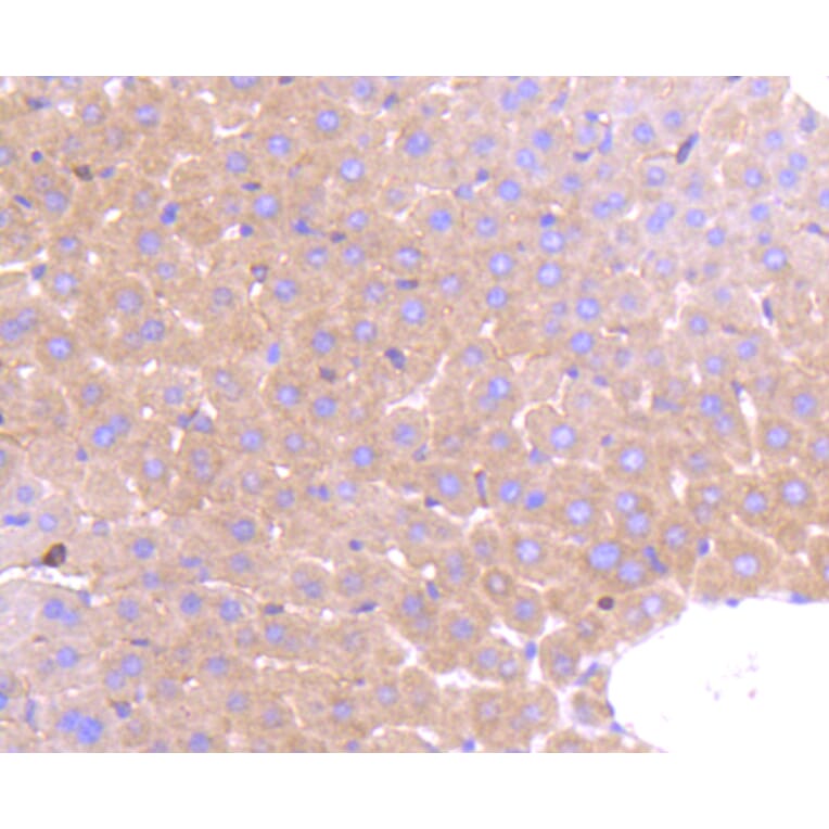 Immunohistochemistry - Anti-PRMT5 Antibody (A11335) - Antibodies.com