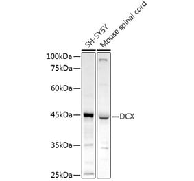 Western Blot - Anti-Doublecortin Antibody (A13291) - Antibodies.com