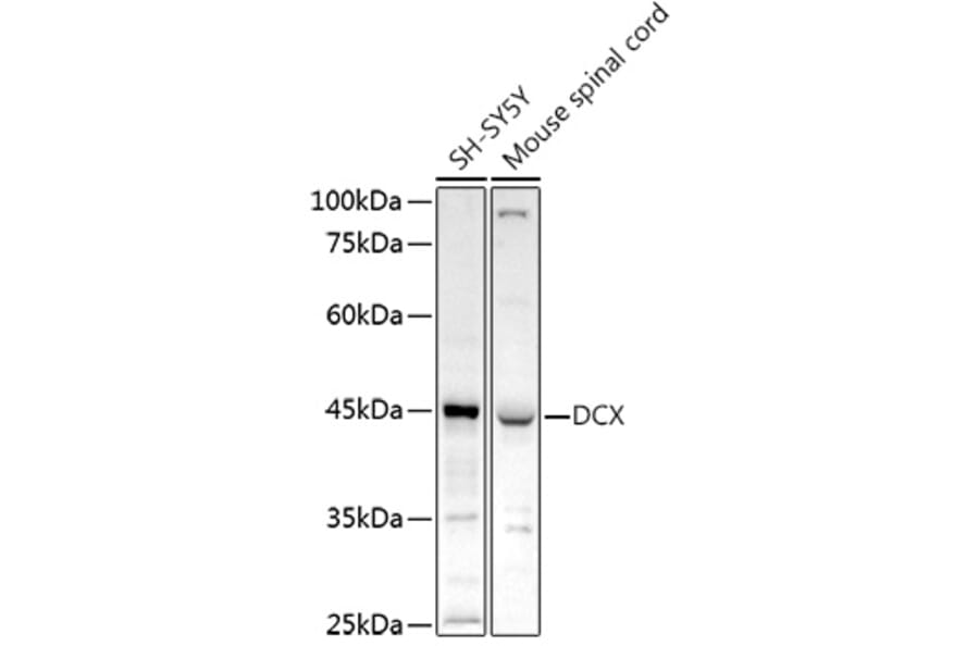 Western Blot - Anti-Doublecortin Antibody (A13291) - Antibodies.com