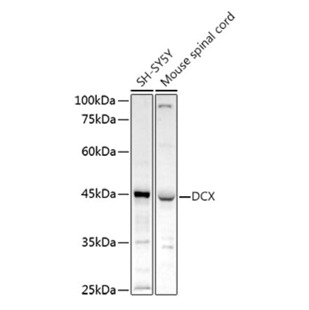 Western Blot - Anti-Doublecortin Antibody (A13291) - Antibodies.com