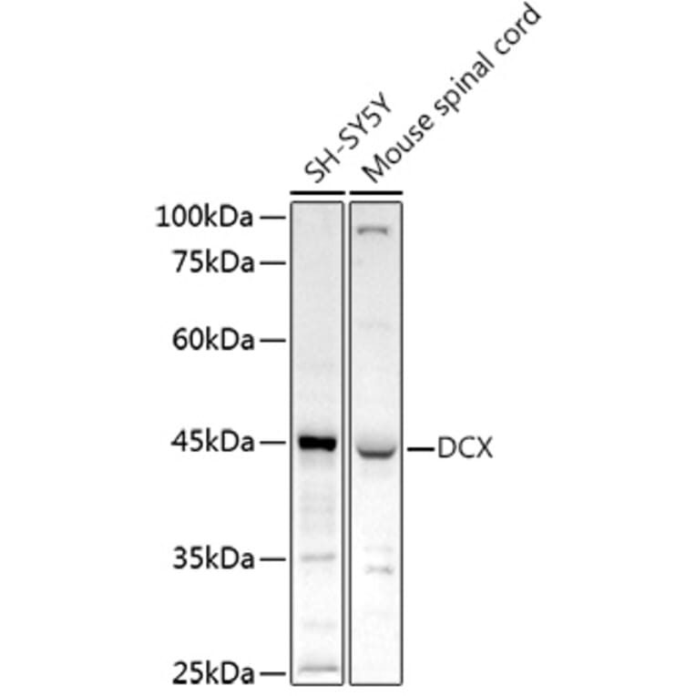 Western Blot - Anti-Doublecortin Antibody (A13291) - Antibodies.com