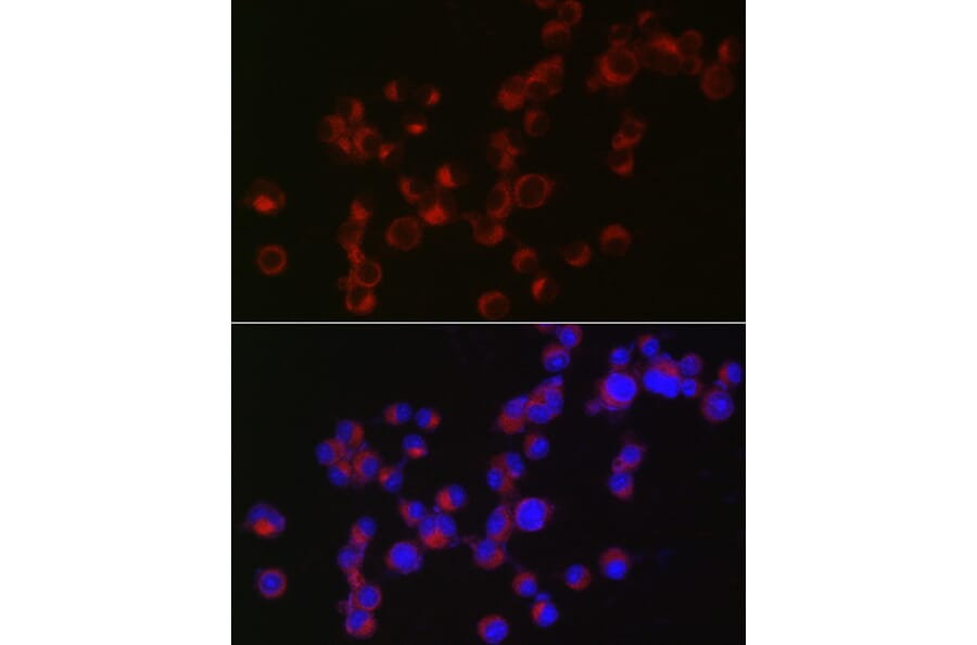 Immunofluorescence - Anti-Doublecortin Antibody (A13291) - Antibodies.com
